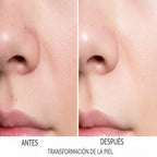 Limpiador Facial de Micro Burbujas  BubbleSkin™  ➕ Face Cleaner 🆓