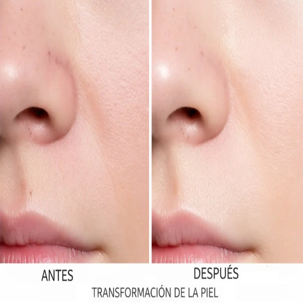 Limpiador Facial de Micro Burbujas  BubbleSkin™  ➕ Face Cleaner 🆓